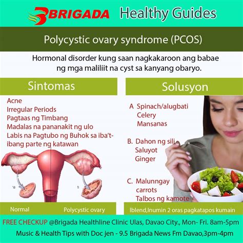 paano malalaman na may pcos ka|PCOS: Mga Mahahalagang Kaalaman at Kahalagahan ng .